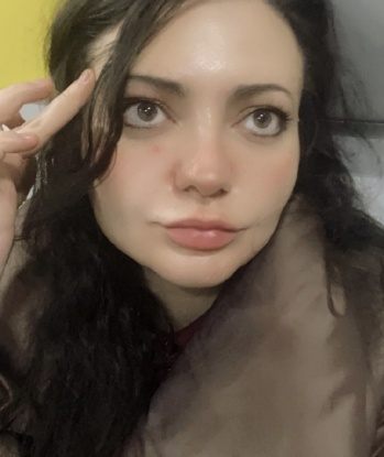 Альбина